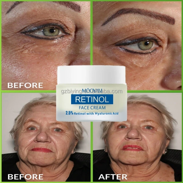 Private Label 2.5% Retinol Collagen Face Cream Retinol Facial Cream with Hyaluronic Acid Night Cream