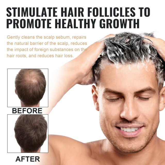Anti hair loss shampoo with strong repair, firming, and hair regeneration properties