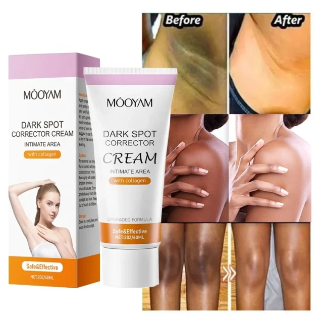 Korean Natural Whitening Body Cream Dark Spot Corrector Strong Remover Black Skin Bleaching Body Cream