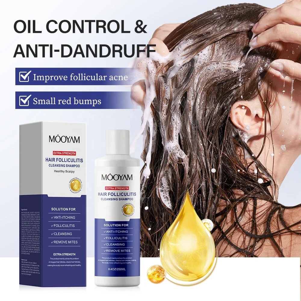 Private Label Folliculitis Shampoo Seborrheic Dermatitis Shampoo, Antifungal Scalp Psoriasis Folliculitis Treatment Shampoo