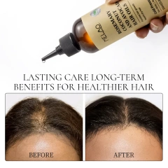 Rosemary Essential Hair Loss Oil Growth Oil Hair Strengthening Dandruff Itchy Deep Rosemary Coconut Avocado Hair Oil