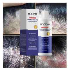 Private Label Folliculitis Shampoo Seborrheic Dermatitis Shampoo, Antifungal Scalp Psoriasis Folliculitis Treatment Shampoo