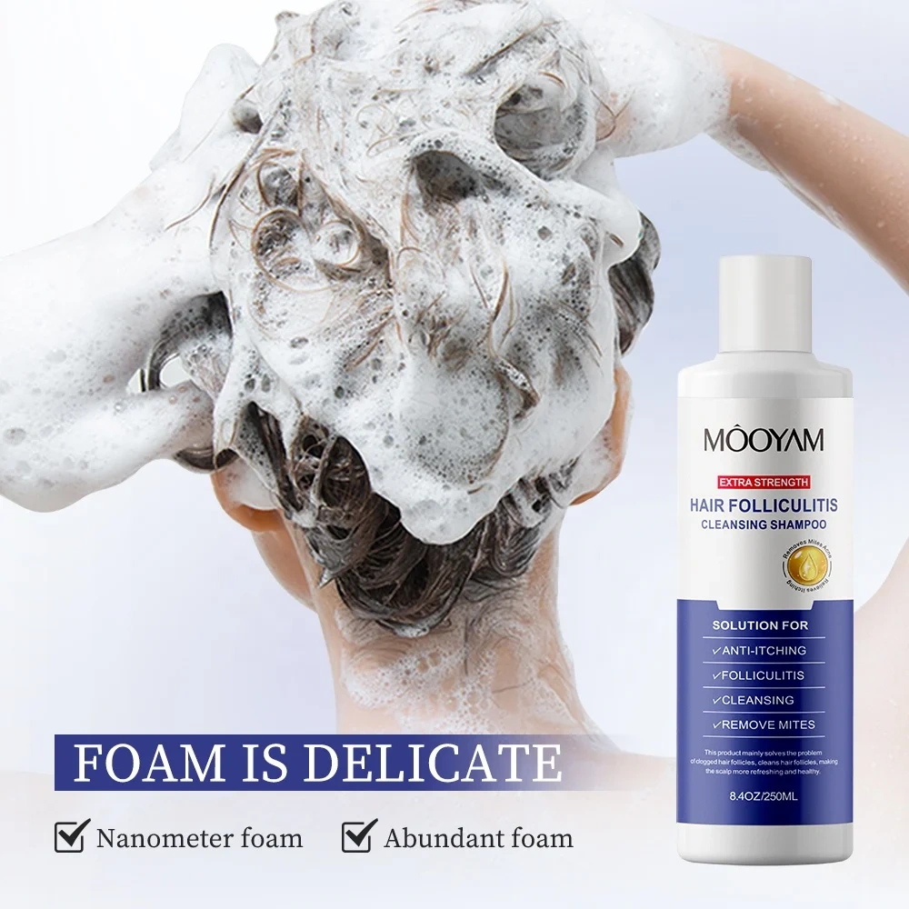 Private Label Folliculitis Shampoo Seborrheic Dermatitis Shampoo, Antifungal Scalp Psoriasis Folliculitis Treatment Shampoo