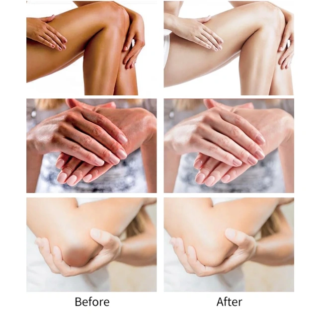 Korean Natural Whitening Body Cream Dark Spot Corrector Strong Remover Black Skin Bleaching Body Cream