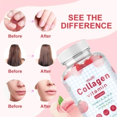 Wholesale Collagen Gummies Vitamin Biotin Supplement Improve Hair Skin and Nails Gummies Vitamin Kollagen Collagen Gummies