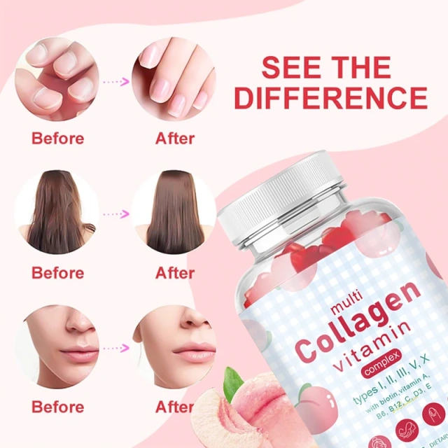 Wholesale Collagen Gummies Vitamin Biotin Supplement Improve Hair Skin and Nails Gummies Vitamin Kollagen Collagen Gummies