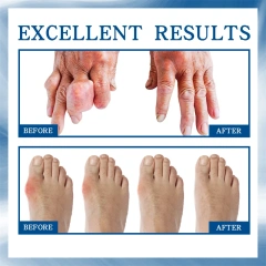 South Moon Joint Bone Repair Ball Sore Eliminating Joint Pain Relieving Roller Liquid Tendon Repairing Joint Care Ball Fluid