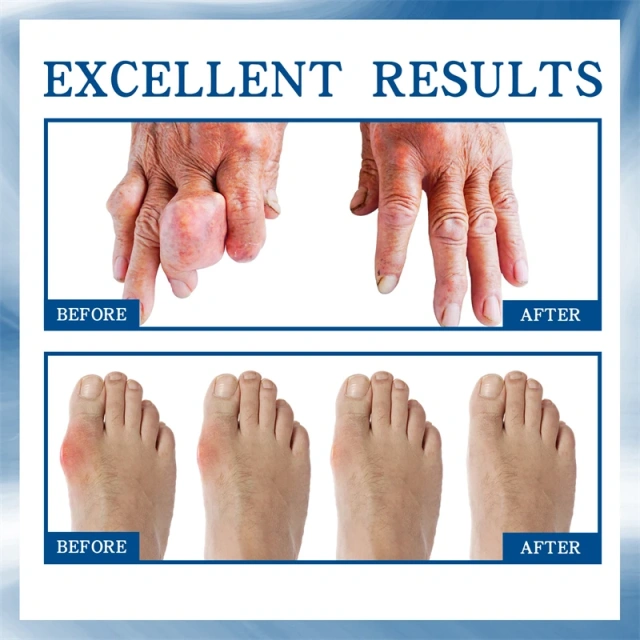 South Moon Joint Bone Repair Ball Sore Eliminating Joint Pain Relieving Roller Liquid Tendon Repairing Joint Care Ball Fluid