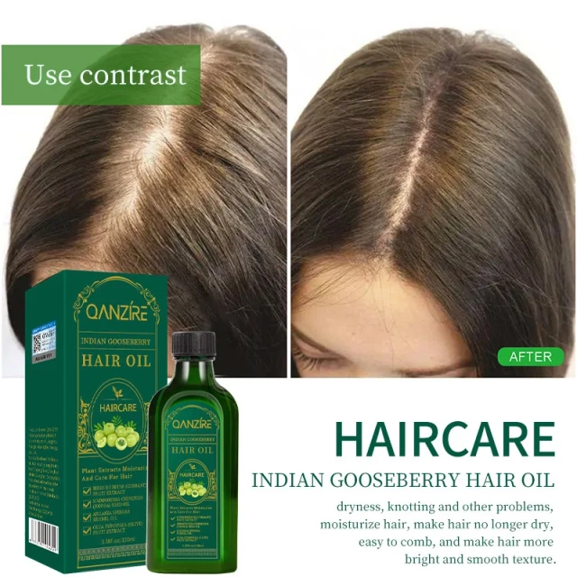 Herbal Men Women Scalp Care Private Label 100% Natural Organic Anti Loss Boosting Gooseberry Hair Treatment Growth Oil