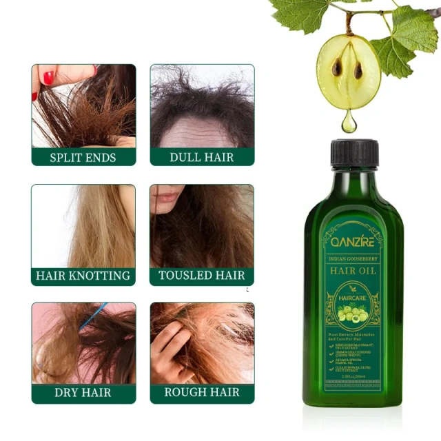 Herbal Men Women Scalp Care Private Label 100% Natural Organic Anti Loss Boosting Gooseberry Hair Treatment Growth Oil