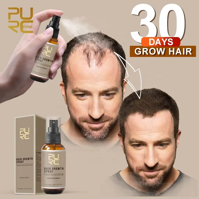 Wholesale Organic Fast Hair Growth Oil Best Hair Regrowth Spray Anti Loss Ginger Natural Hair Growth Serum Oil Private Label