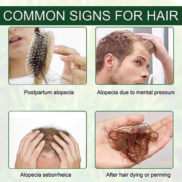 Wholesale Hair Growth Serum Private Label Hair Loss Treatment 100% Organic Vegan Rosemary Oil for Hair Growth