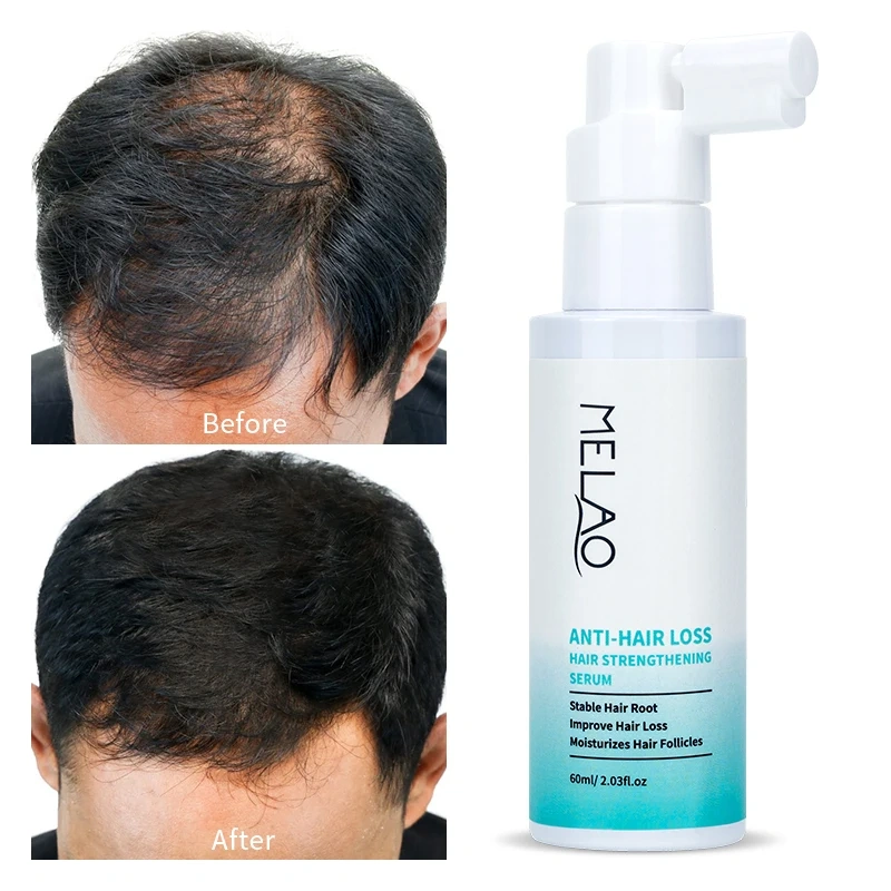 Hair Growth Oil Private Label Advanced Bald Improve Wild Fast Hair Oils for Hair Growth Organic Serum Products Plant Oil