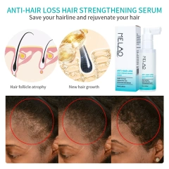 Hair Growth Oil Private Label Advanced Bald Improve Wild Fast Hair Oils for Hair Growth Organic Serum Products Plant Oil