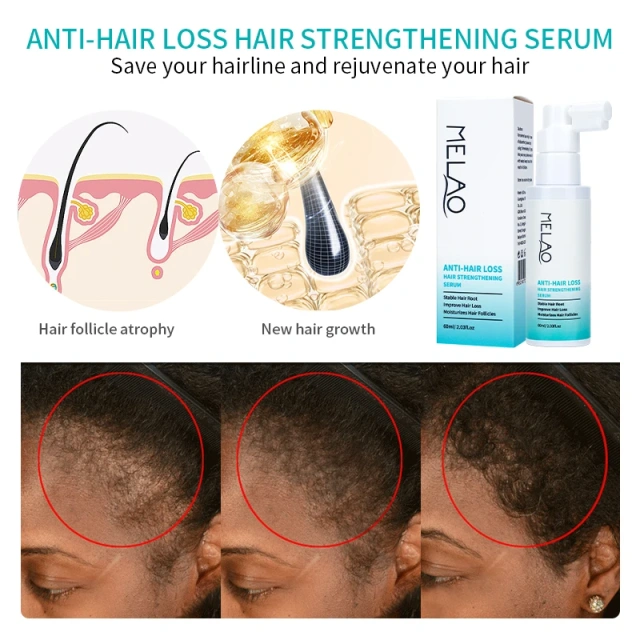 Hair Growth Oil Private Label Advanced Bald Improve Wild Fast Hair Oils for Hair Growth Organic Serum Products Plant Oil