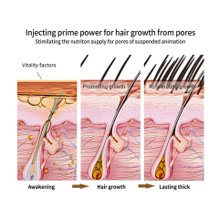 Wholesale Organic Fast Hair Growth Oil Best Hair Regrowth Spray Anti Loss Ginger Natural Hair Growth Serum Oil Private Label