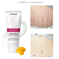 Private Label Skin Care Products Massage Repair Remover Cream Strong Effective Scar Stretch Mark Cream