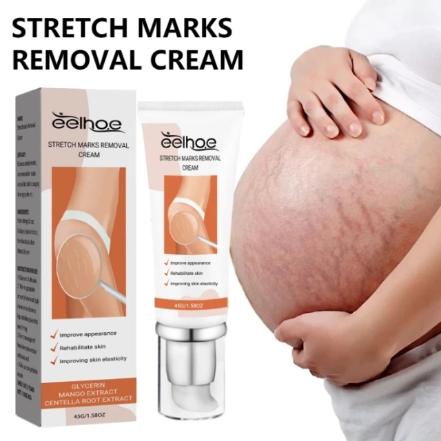 Best Selling Vegan Frmula Mild and Non-Irritating Fast Acting Smooth Skin Stretch Mark Repair Cream
