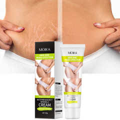 High Quality Stretch Marks Remover Skin Repair Cream Treatment Scar Removal Pregnancy Cream