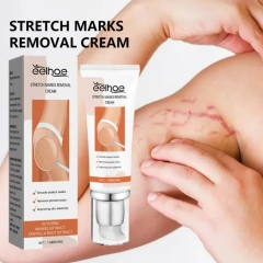 Best Selling Vegan Frmula Mild and Non-Irritating Fast Acting Smooth Skin Stretch Mark Repair Cream