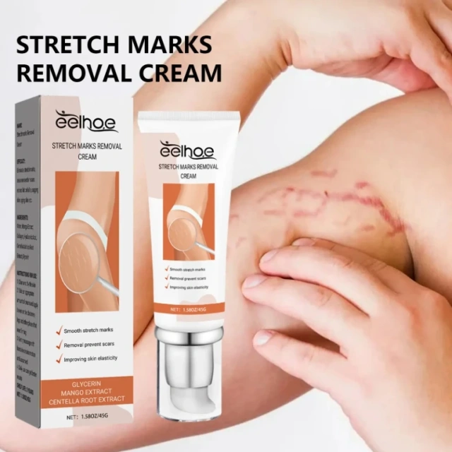 Best Selling Vegan Frmula Mild and Non-Irritating Fast Acting Smooth Skin Stretch Mark Repair Cream