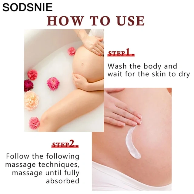 Body Creams Remove Pregnancy Scars Acne Cream Stretch Marks Treatment Maternity Repair Anti-Aging Anti-Winkles Firming Skin Care