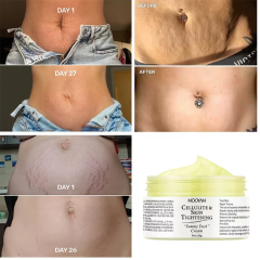 Private Label Organic Body Cellulite and Stretch Mark Cream Tummy Tuck Tightening Stretch Mark Removal Cream