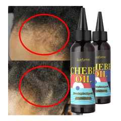 Oalen Wholesale Natural and Pure Nourishing Dry Scalp Fast Hair Growth Oil Chebe Hair Oil Products