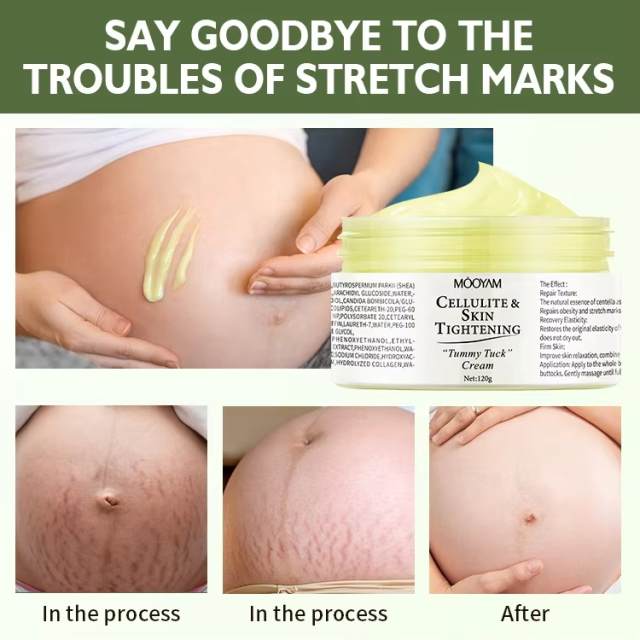 Private Label Organic Body Cellulite and Stretch Mark Cream Tummy Tuck Tightening Stretch Mark Removal Cream