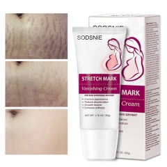 Body Creams Remove Pregnancy Scars Acne Cream Stretch Marks Treatment Maternity Repair Anti-Aging Anti-Winkles Firming Skin Care