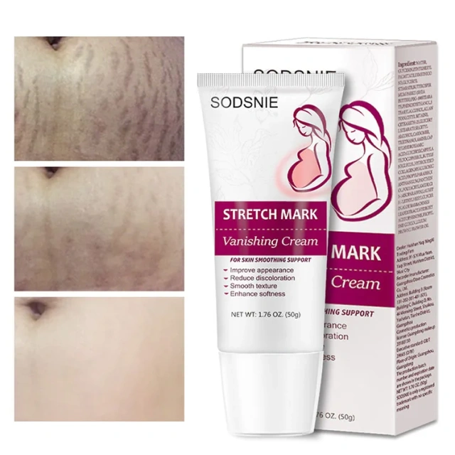 Body Creams Remove Pregnancy Scars Acne Cream Stretch Marks Treatment Maternity Repair Anti-Aging Anti-Winkles Firming Skin Care