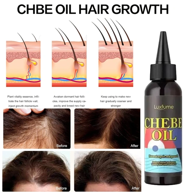 Oalen Wholesale Natural and Pure Nourishing Dry Scalp Fast Hair Growth Oil Chebe Hair Oil Products