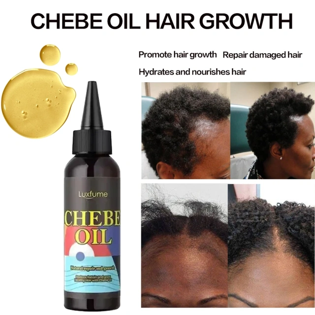 Oalen Wholesale Natural and Pure Nourishing Dry Scalp Fast Hair Growth Oil Chebe Hair Oil Products