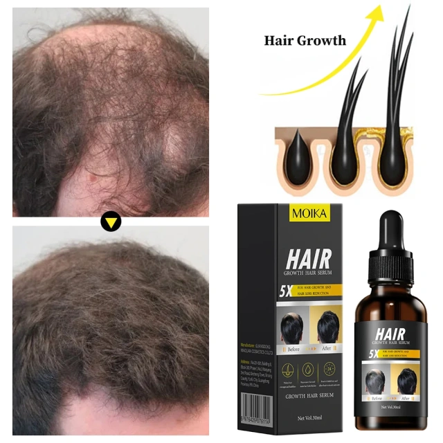 High Quality Organic Rosemary Hair Serum Oil Hair Care Essential Oil for Hair Regrowth
