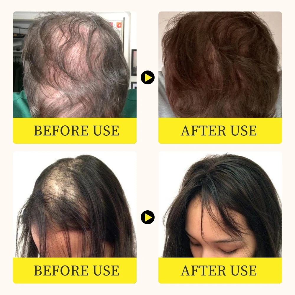 High Quality Organic Rosemary Hair Serum Oil Hair Care Essential Oil for Hair Regrowth