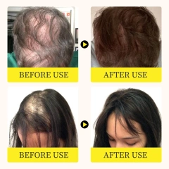 High Quality Organic Rosemary Hair Serum Oil Hair Care Essential Oil for Hair Regrowth