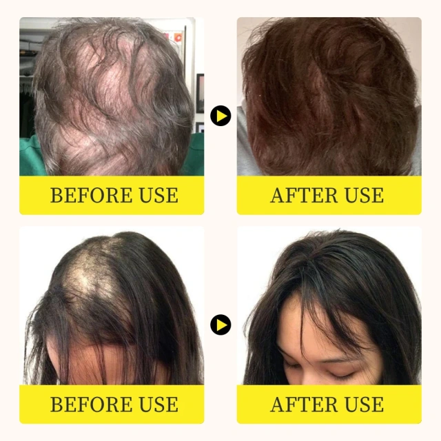 High Quality Organic Rosemary Hair Serum Oil Hair Care Essential Oil for Hair Regrowth