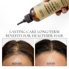 Non Greasy 3-In-1 Rosemary Oil Scalp & Hair Strengthening 100% Pure Natural Rosemary Oil Hair Growth
