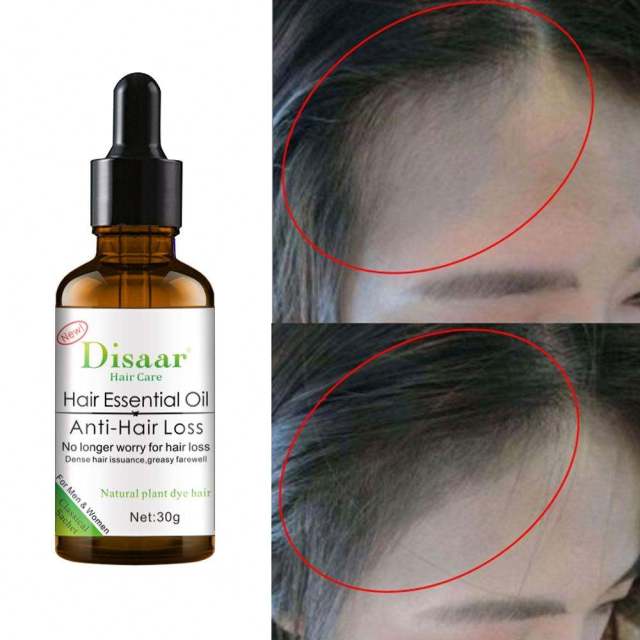 Dissar Wholesale Private Label Organic Professional Hair Care Anti-Hair Loss Hair Essential Oil for Men and Women 30G