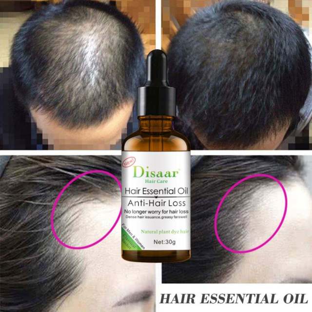 Dissar Wholesale Private Label Organic Professional Hair Care Anti-Hair Loss Hair Essential Oil for Men and Women 30G