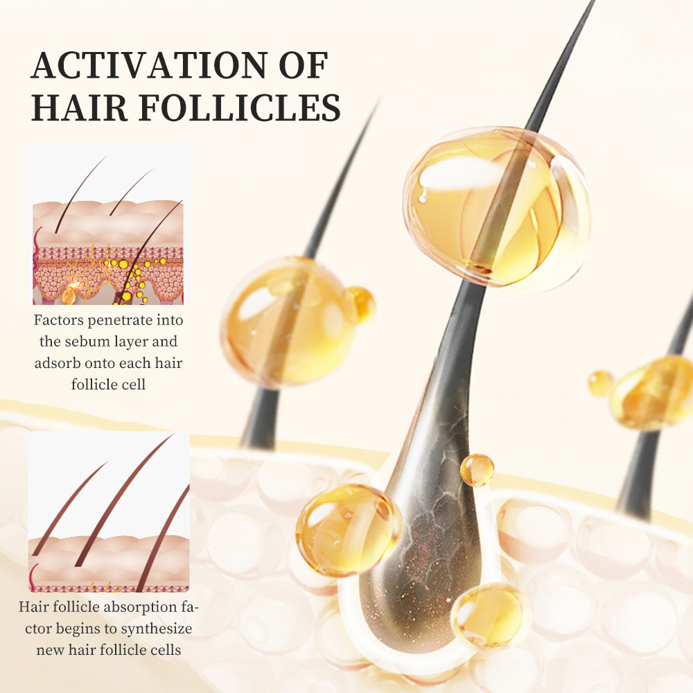 Wholesale Customized logo Hair Care Nutrients Nourish the Scalp Strengthen and Show off Hair Growth Liquid