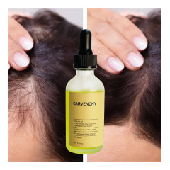 Customized Private Label Natural Organic Growth Hair Oil Anti Hair Loss Treatment for Baldness 60ml Hair Growth Oil