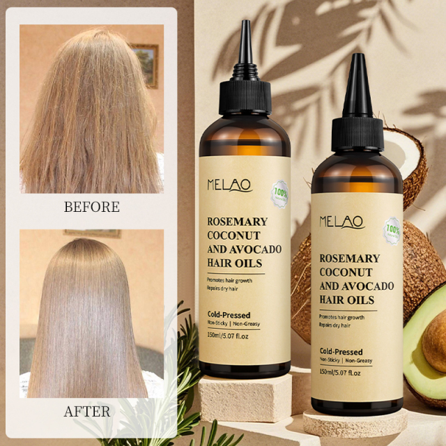 Non Greasy 3-In-1 Rosemary Oil Scalp & Hair Strengthening 100% Pure Natural Rosemary Oil Hair Growth
