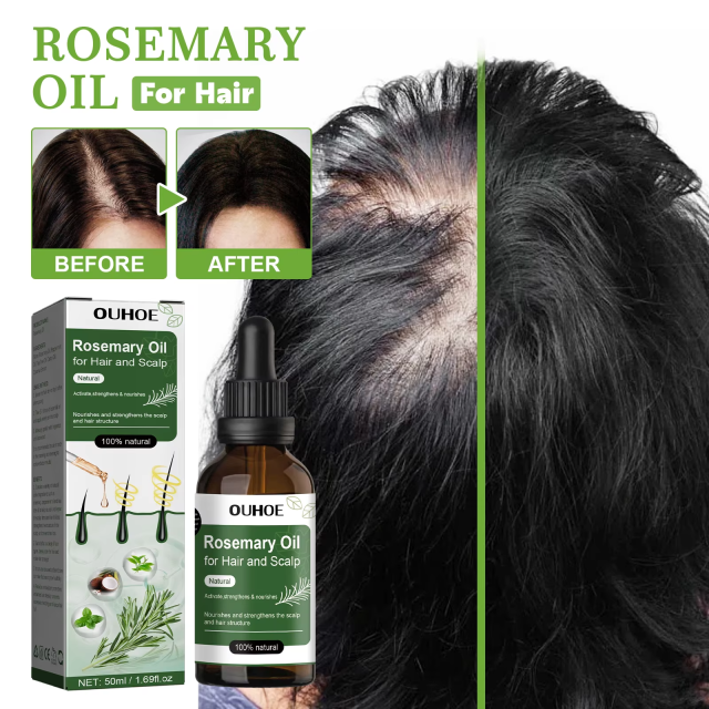 100% Natural Thickening Hair Growth Hair Scalp Care Rosemary Essential Oil for Hair Scalp Activate, Strengthen and Nourish