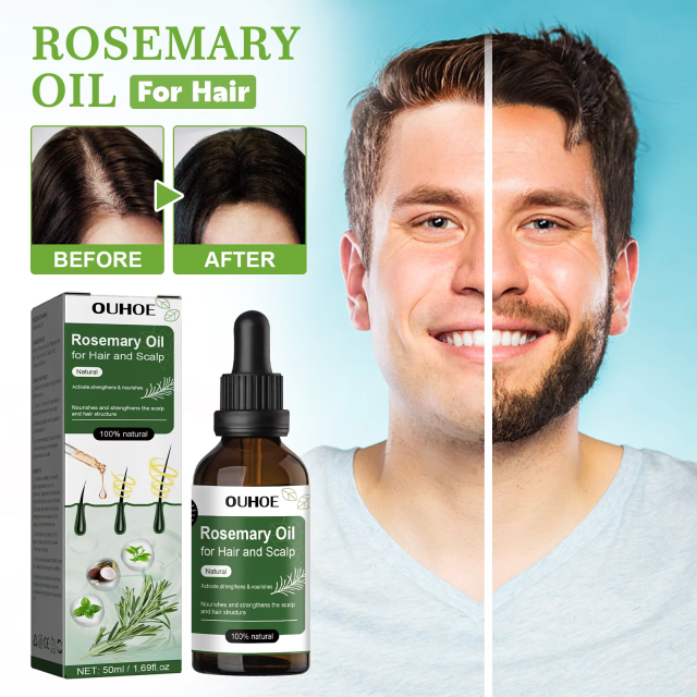 100% Natural Thickening Hair Growth Hair Scalp Care Rosemary Essential Oil for Hair Scalp Activate, Strengthen and Nourish