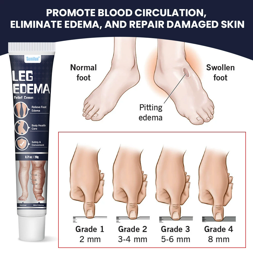 Sumifun Body Health Care Ointment for Eliminate Edema 20g Natural Herbal Eliminate Swelling Cream