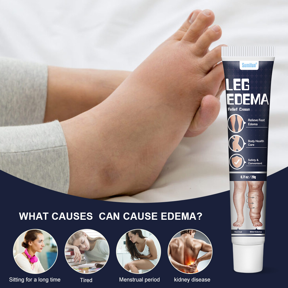 Sumifun Body Health Care Ointment for Eliminate Edema 20g Natural Herbal Eliminate Swelling Cream