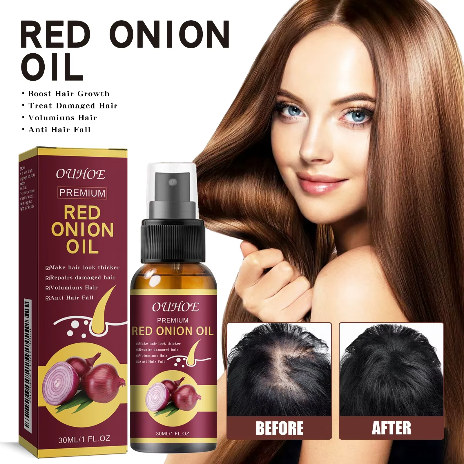 Natural Organic Scalp Vegan Red Onion Extract Hair Regrowth Essential Oil Damaged Hair  Loss Treatment Hair Care Oil