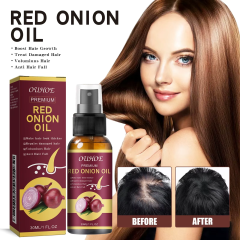 Natural Organic Scalp Vegan Red Onion Extract Hair Regrowth Essential Oil Damaged Hair  Loss Treatment Hair Care Oil