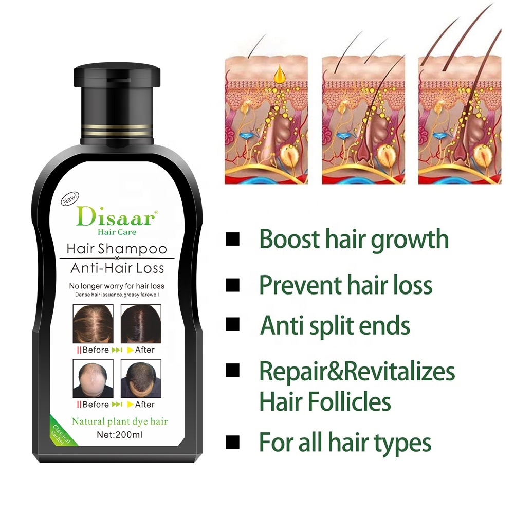Disaar Anti Hair Loss Shampoo Organizer Men and Women Natural Ginger Growth Hair Shampoo for Damage Hair